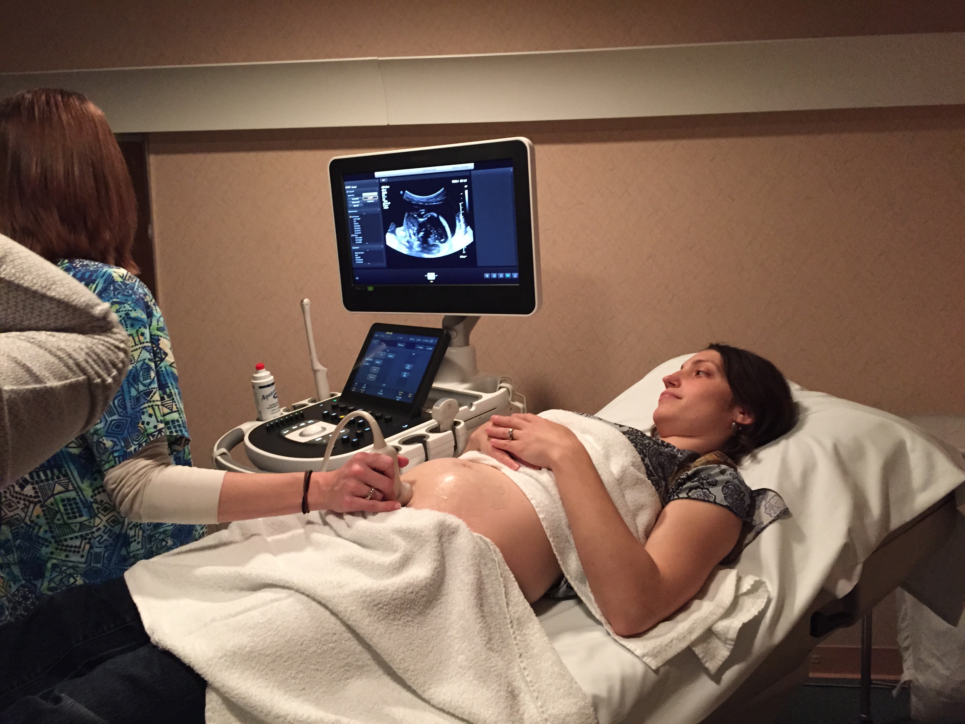20 Week Ultrasound